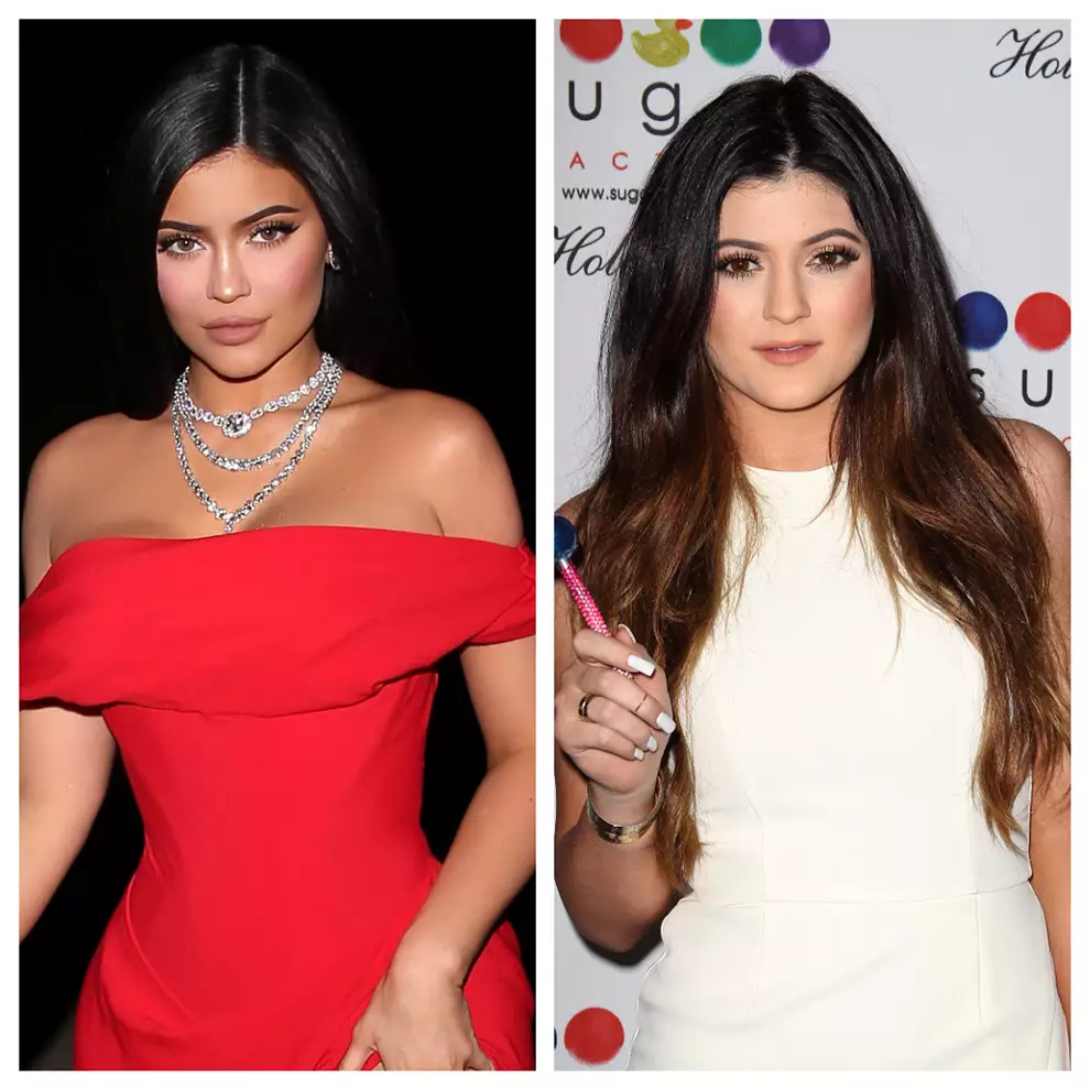 Antes y después famosos Kylie Jenner