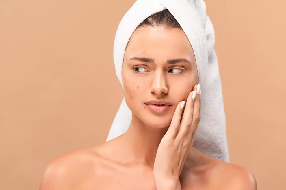 propiedades del magnesio pieles con acne
